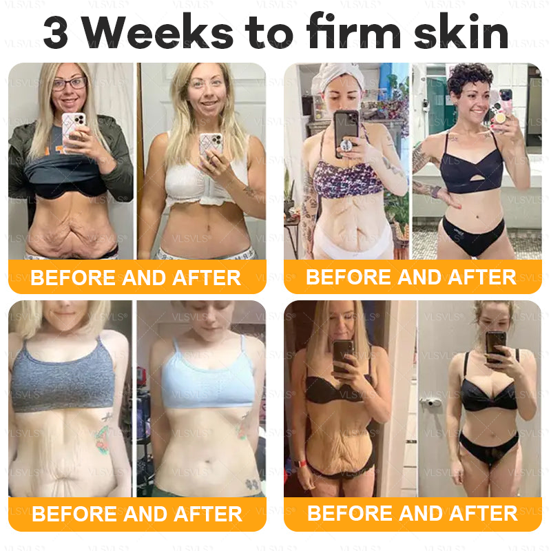 Made and Shipped from USA  🎉🎉𝑽𝑳𝑺𝑽𝑳𝑺® Bee Venom Comprehensive Cream  LAST DAY 80% OFF(Sagging Skin, Fine Lines, Loss of Firmness, Flat Bust, Drooping Hips, and More)