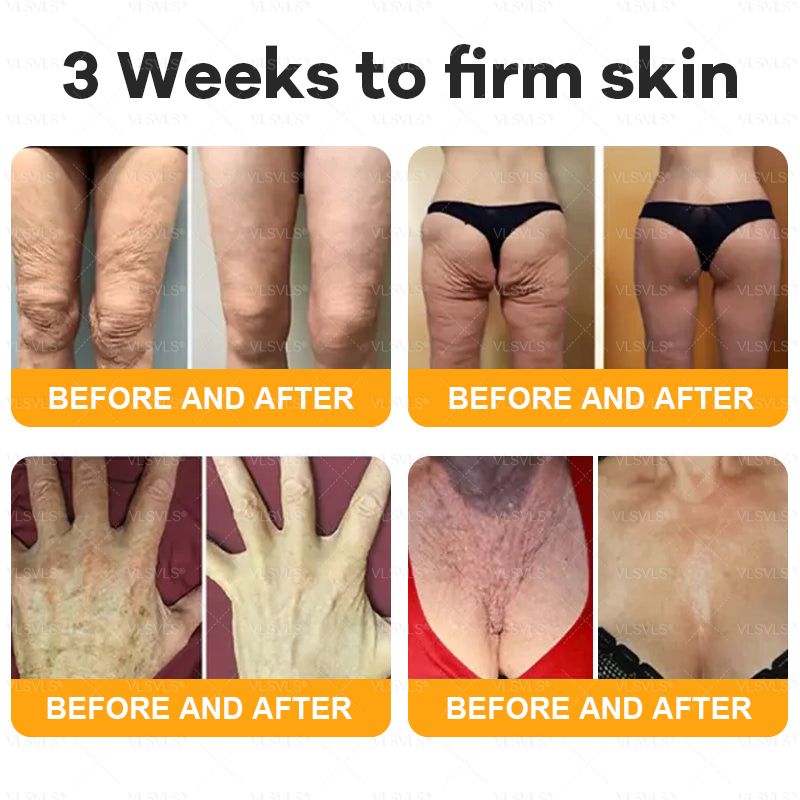 Made and Shipped from USA  🎉🎉𝑽𝑳𝑺𝑽𝑳𝑺® Bee Venom Comprehensive Cream  LAST DAY 80% OFF(Sagging Skin, Fine Lines, Loss of Firmness, Flat Bust, Drooping Hips, and More)