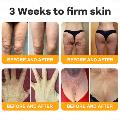Made and Shipped from USA  🎉🎉𝑽𝑳𝑺𝑽𝑳𝑺® Bee Venom Comprehensive Cream  LAST DAY 80% OFF(Sagging Skin, Fine Lines, Loss of Firmness, Flat Bust, Drooping Hips, and More)