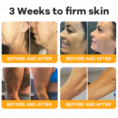 Made and Shipped from USA  🎉🎉𝑽𝑳𝑺𝑽𝑳𝑺® Bee Venom Comprehensive Cream  LAST DAY 80% OFF(Sagging Skin, Fine Lines, Loss of Firmness, Flat Bust, Drooping Hips, and More)